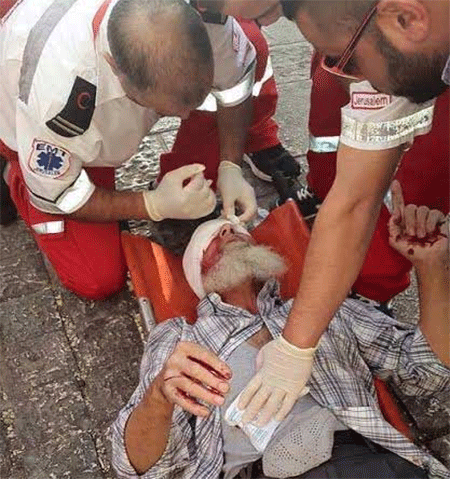 el anciano que fue alcanzado por una bala de goma en un ojo La ocupación sionista irrumpe en la Mezquita de Al Aqsa